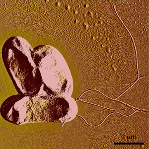 Colon bacillus observed with an atomic force microscope