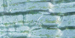 光学顕微鏡で観察したオオカナダモの葉の様子。緑色の葉緑体は観察できるが、その他の細胞内構造を見つけるのは難しい。